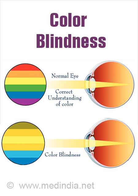Colour Blindness