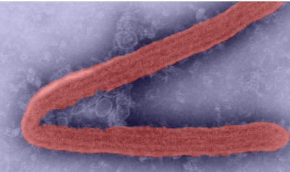 Marburg virus disease (MVD)